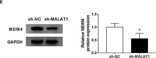 Fig.7.E showing Western Blotting from the publication: LncRNA MALAT1 accelerates non-small cell lung cancer progression via regulating miR-185-5p/MDM4 axis.