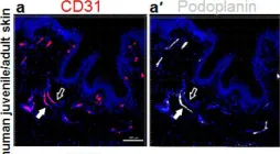 Fig.1.A showing Immunohistochemistry-immunofluorescence from the publication: The Role of CD200-CD200 Receptor in Human Blood and Lymphatic Endothelial Cells in the Regulation of Skin Tissue Inflammation.