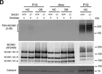 Fig.7.D showing Western Blotting from the publication: Spatiotemporal processing of neural cell adhesion molecules 1 and 2 by BACE1 in vivo.