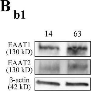 Fig.3.B showing Western Blotting in a Homo sapiens (Human) sample from the publication: Neuroprotective Potential of L-Glutamate Transporters in Human Induced Pluripotent Stem Cell-Derived Neural Cells against Excitotoxicity.