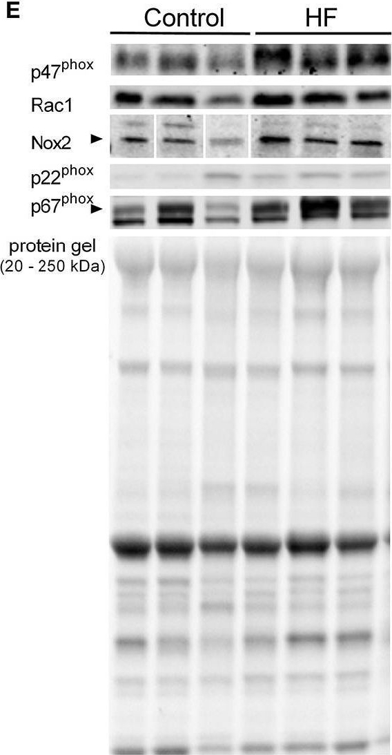 Fig.1.E showing Western Blotting in a Homo sapiens (Human) sample from the publication: Diaphragm Abnormalities in Patients with End-Stage Heart Failure: NADPH Oxidase Upregulation and Protein Oxidation.