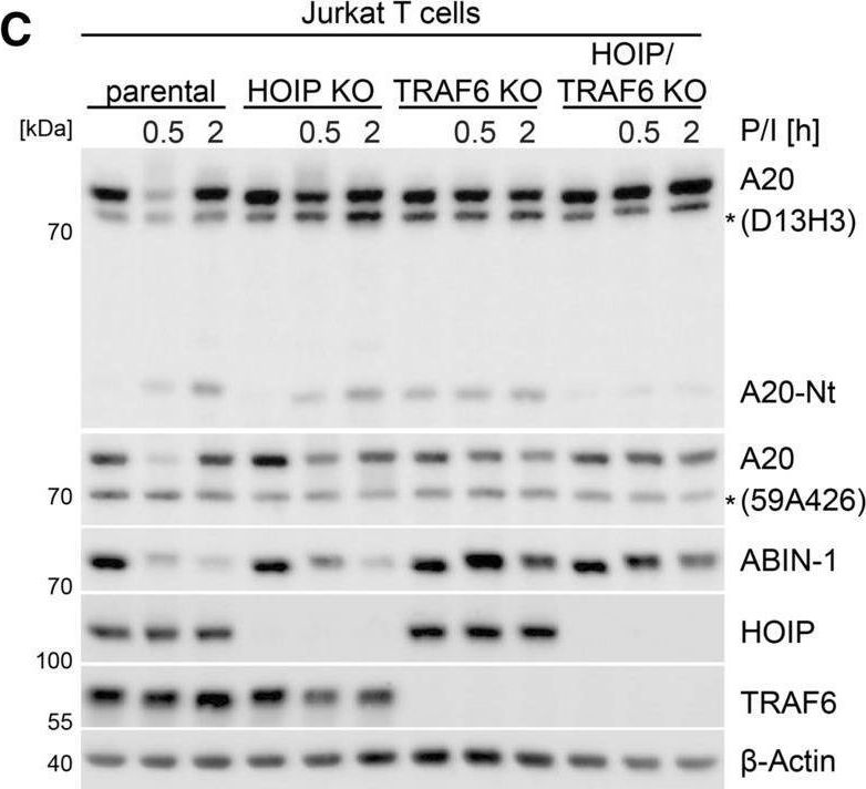 Fig.7.C showing Western Blotting in a Homo sapiens (Human) sample from the publication: A20 and ABIN-1 cooperate in balancing CBM complex-triggered NF-κB signaling in activated T cells.