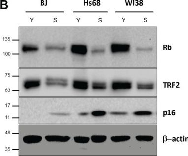 Fig.3.B showing Western Blotting in a Homo sapiens (Human) sample from the publication: hTERT Increases TRF2 to Induce Telomere Compaction and Extend Cell Replicative Lifespan.