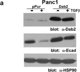 Fig.4.A showing Western Blotting in a Homo sapiens (Human) sample from the publication: Loss of Disabled-2 Expression in Pancreatic Cancer Progression.