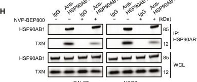 Fig.4.H showing Western Blotting in a Homo sapiens (Human) sample from the publication: Hypoxic Reprogramming of ACOX1-Driven HSP90AB1 Crotonylation Stabilizes Thioredoxin to Orchestrate Redox Homeostasis in Oral Squamous Cell Carcinoma.