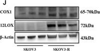 Fig.1.J showing Western Blotting in a Homo sapiens (Human) sample from the publication: The SP1-12LOX axis promotes chemoresistance and metastasis of ovarian cancer.