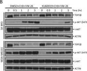 Fig.4.B showing Western Blotting in a Homo sapiens (Human) sample from the publication: SCFβ-TrCP-mediated degradation of TOP2β promotes cancer cell survival in response to chemotherapeutic drugs targeting topoisomerase II.