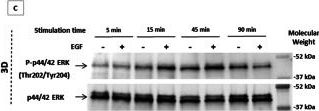 Phospho-p44/42 MAPK (Erk1/2) (Thr202/Tyr204) (E10) Mouse mAb