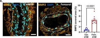 Fig.1.K showing Immunohistochemistry-immunofluorescence in a Homo sapiens (Human) sample from the publication: DDR1 Regulates Femoral Arterial Calcification in Lower-Extremity Artery Disease Through NF-Kappa B Activation.