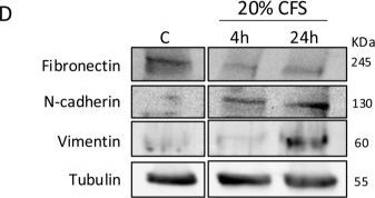 Fig.2.D showing Western Blotting in a Homo sapiens (Human) sample from the publication: Porphyromonas gingivalis secreted factors drive epithelial-mesenchymal transition (EMT) through gingipains and an H2S-mediated bacterial defense system.