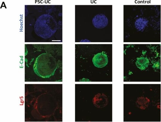 Fig.2.A showing Immunocytochemistry-immunofluorescence from the publication: Overexpression of Cancer-Associated Stem Cell Gene OLFM4 in the Colonic Epithelium of Patients With Primary Sclerosing Cholangitis.