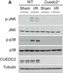 Fig.3.A showing Western Blotting in a Mus musculus (House mouse) sample from the publication: CUEDC2 modulates cardiomyocyte oxidative capacity by regulating GPX1 stability.
