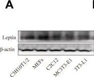 Fig.2.A showing Western Blotting from the publication: Leptin attenuates the osteogenic induction potential of BMP9 by increasing β-catenin malonylation modification via Sirt5 down-regulation.