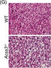 Fig.2.G showing Immunohistochemistry in a Mus musculus (House mouse) sample from the publication: ACSS3 in brown fat drives propionate catabolism and its deficiency leads to autophagy and systemic metabolic dysfunction.