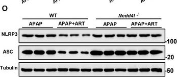 Fig.5.O showing Western Blotting from the publication: Artesunate Ameliorates APAP-induced Liver Injury by Promoting NEDD4L-Mediated Ubiquitination and Degradation of TXNIP.