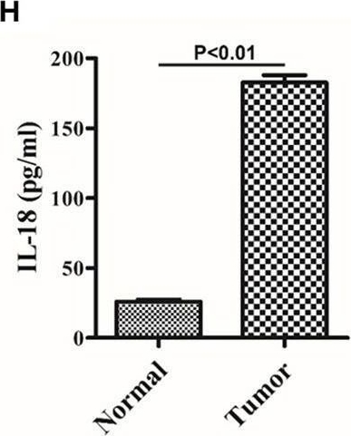 Fig.2.H showing Enzyme-linked immunosorbent assay from the publication: Antitumor Effects of Berberine on Gliomas via Inactivation of Caspase-1-Mediated IL-1β and IL-18 Release.