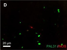 Fig.2.D showing Immunohistochemistry-immunofluorescence in a Rattus norvegicus (Rat) sample from the publication: Cytoprotective and anti-inflammatory effects of PAL31 overexpression in glial cells.