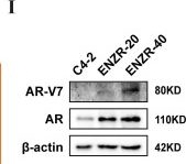 Fig.1.I showing Western Blotting from the publication: NDR1 enhances USP9X-mediated AR deubiquitination and promotes enzalutamide resistance in castration-resistant prostate cancer.