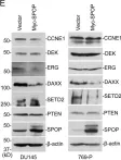 Fig.6.E showing Western Blotting in a Homo sapiens (Human) sample from the publication: SPOP suppresses prostate cancer through regulation of CYCLIN E1 stability.