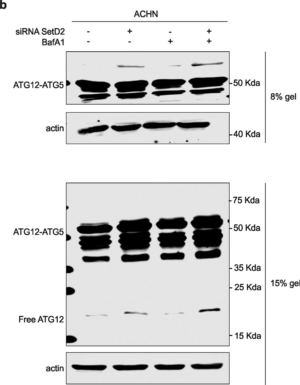 Fig.6.B showing Western Blotting in a Homo sapiens (Human) sample from the publication: SETD2 mutation in renal clear cell carcinoma suppress autophagy via regulation of ATG12.