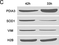 Fig.4.C showing Western Blotting in a Sus scrofa domesticus (Domestic pig) sample from the publication: Discovery of porcine maternal factors related to nuclear reprogramming and early embryo development by proteomic analysis.