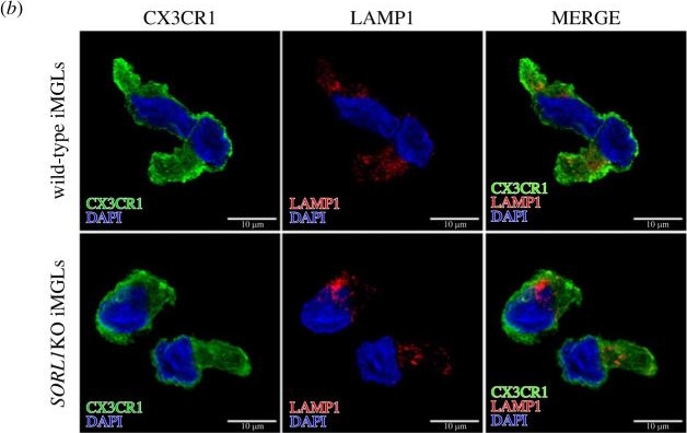 Fig.1.B showing Immunocytochemistry-immunofluorescence in a Homo sapiens (Human) sample from the publication: Differential effects of SORL1 deficiency on the endo-lysosomal network in human neurons and microglia.