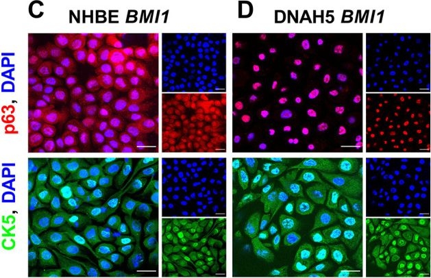 Fig.1.C showing Immunocytochemistry-immunofluorescence in a Homo sapiens (Human) sample from the publication: Characterisation of a primary ciliary dyskinesia model generated from BMI1-transduced basal epithelial cells.