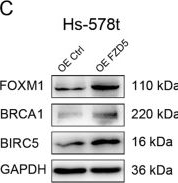 Fig.6.C showing Western Blotting in a Homo sapiens (Human) sample from the publication: FZD5 contributes to TNBC proliferation, DNA damage repair and stemness.