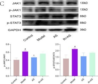 Fig.9.C showing Western Blotting in a Homo sapiens (Human) sample from the publication: Artemisia scoparia extract inhibits oxidative stress and ferroptosis to ameliorate MASH through AGE-RAGE and JAK1-STAT3 signaling.