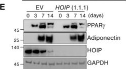 Fig.5.E showing Western Blotting in a Homo sapiens (Human) sample from the publication: Linear ubiquitination prevents lipodystrophy and obesity-associated metabolic syndrome.