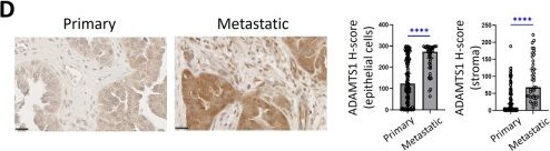 Fig.1.D showing Immunohistochemistry from the publication: Enhanced expression of ADAMTS1 in ovarian carcinomas: loss of ADAMTS1 expression instigates cellular reprogramming of extracellular matrix ensuing altered plasticity, augmented migration and attenuated adhesion.