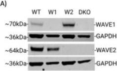 Fig.2.A showing Western Blotting from the publication: Human Papillomavirus Type 16 Stimulates WAVE1- and WAVE2-Dependent Actin Protrusions for Endocytic Entry.