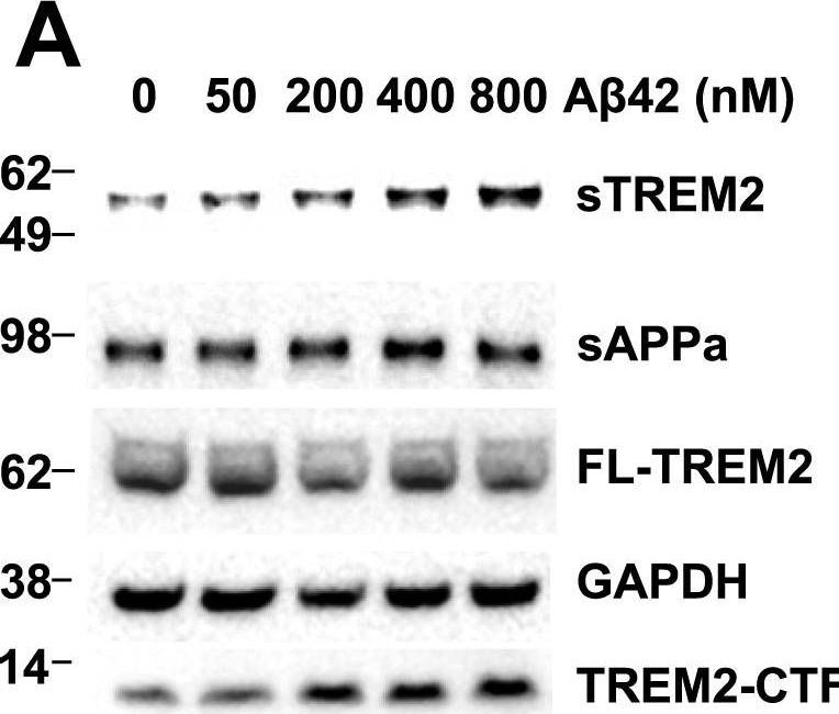 TREM2 antibodies - Antibody search engine - CiteAb