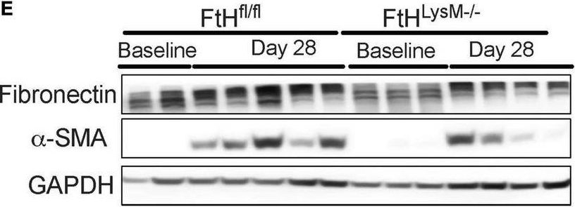 Fig.7.W showing Western Blotting from the publication: Functional consequence of myeloid ferritin heavy chain on acute and chronic effects of rhabdomyolysis-induced kidney injury.