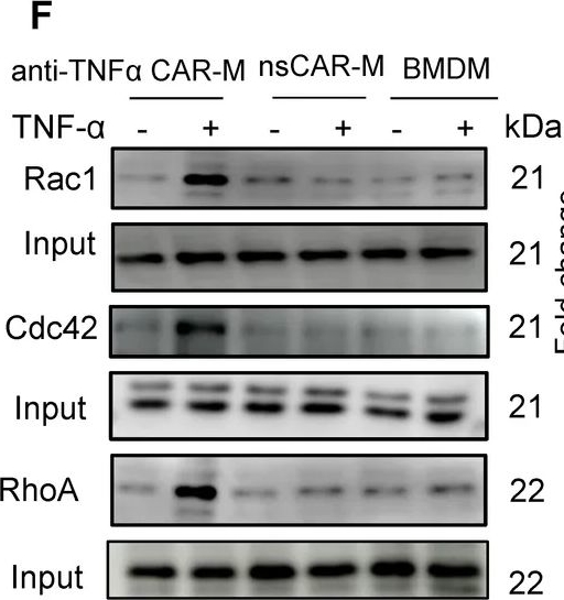Fig.2.F showing Western Blotting from the publication: Targeted phagocytosis of TNF-α by CAR macrophages restores immune homeostasis in arthritis.