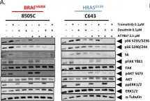 Fig.6.A showing Western Blotting in a Homo sapiens (Human) sample from the publication: Src-mediated regulation of the PI3K pathway in advanced papillary and anaplastic thyroid cancer.