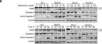 Fig.2.B showing Western Blotting from the publication: Salinomycin effectively eliminates cancer stem-like cells and obviates hepatic metastasis in uveal melanoma.