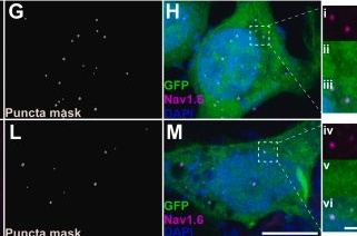 Fig.2.G showing Immunocytochemistry-immunofluorescence in a Homo sapiens (Human) sample from the publication: Axin-binding domain of glycogen synthase kinase 3β facilitates functional interactions with voltage-gated Na+&nbsp;channel Nav1.6.