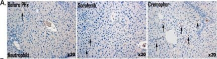 Fig.4.A showing Immunohistochemistry-paraffin in a Mus musculus (House mouse) sample from the publication: Sorafenib treatment during partial hepatectomy reduces tumorgenesis in an inflammation-associated liver cancer model.
