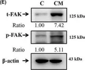 Fig.4.E showing Western Blotting from the publication: Oral submucous fibrosis stimulates invasion and epithelial-mesenchymal transition in oral squamous cell carcinoma by activating MMP-2 and IGF-IR.