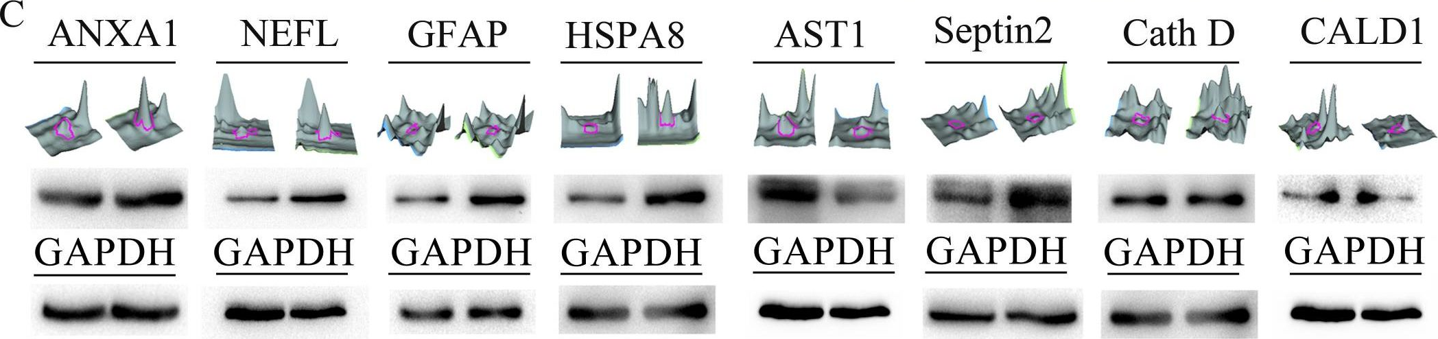 Fig.1.C showing Western Blotting in a Homo sapiens (Human) sample from the publication: Targeting miR-381-NEFL axis sensitizes glioblastoma cells to temozolomide by regulating stemness factors and multidrug resistance factors.