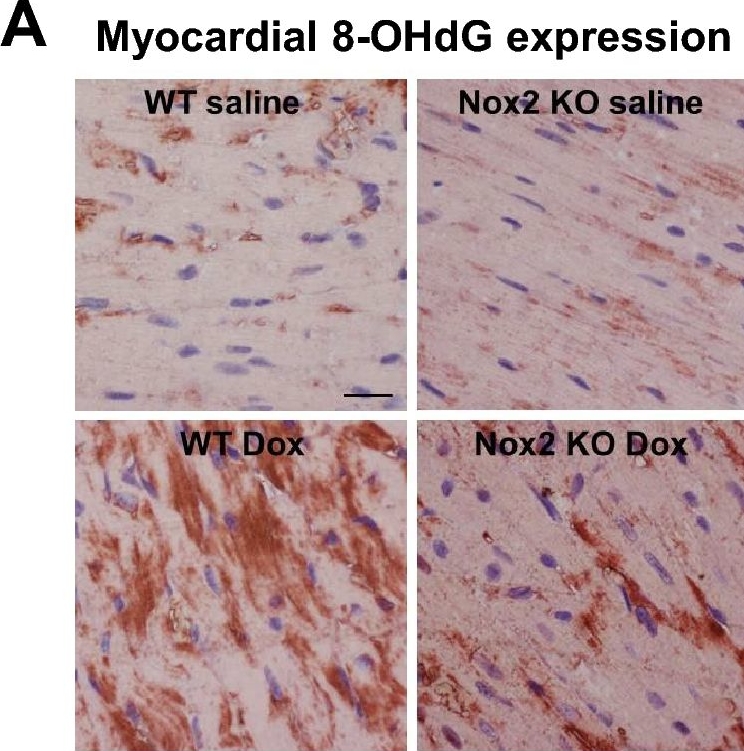 Fig.2.A showing Immunohistochemistry from the publication: NADPH oxidase 2 mediates cardiac sympathetic denervation and myocyte autophagy, resulting in cardiac atrophy and dysfunction in doxorubicin-induced cardiomyopathy.