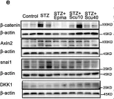 Fig.4.E showing Western Blotting in a Mus musculus (House mouse) sample from the publication: Scutellarin ameliorates diabetic nephropathy via TGF-β1 signaling pathway.