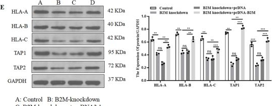 Fig.4.E showing Western Blotting in a Homo sapiens (Human) sample from the publication: B2M drives PD-1 inhibitor resistance in DLBCL through independent dual immune escape mechanisms.