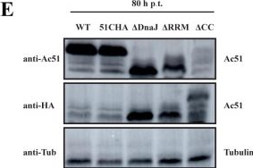 Fig.1.E showing Western Blotting from the publication: Autographa californica multiple nucleopolyhedrovirus Ac51 interacts with Ac66 and facilitates its nuclear localization to promote the nuclear egress of nucleocapsids.