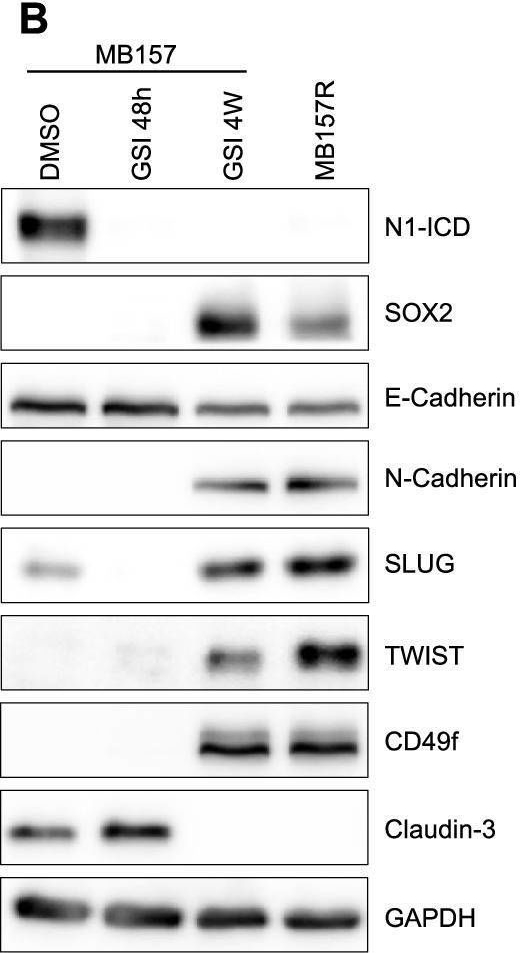 Fig.8.B showing Western Blotting in a Homo sapiens (Human) sample from the publication: Reciprocal inhibition of NOTCH and SOX2 shapes tumor cell plasticity and therapeutic escape in triple-negative breast cancer.