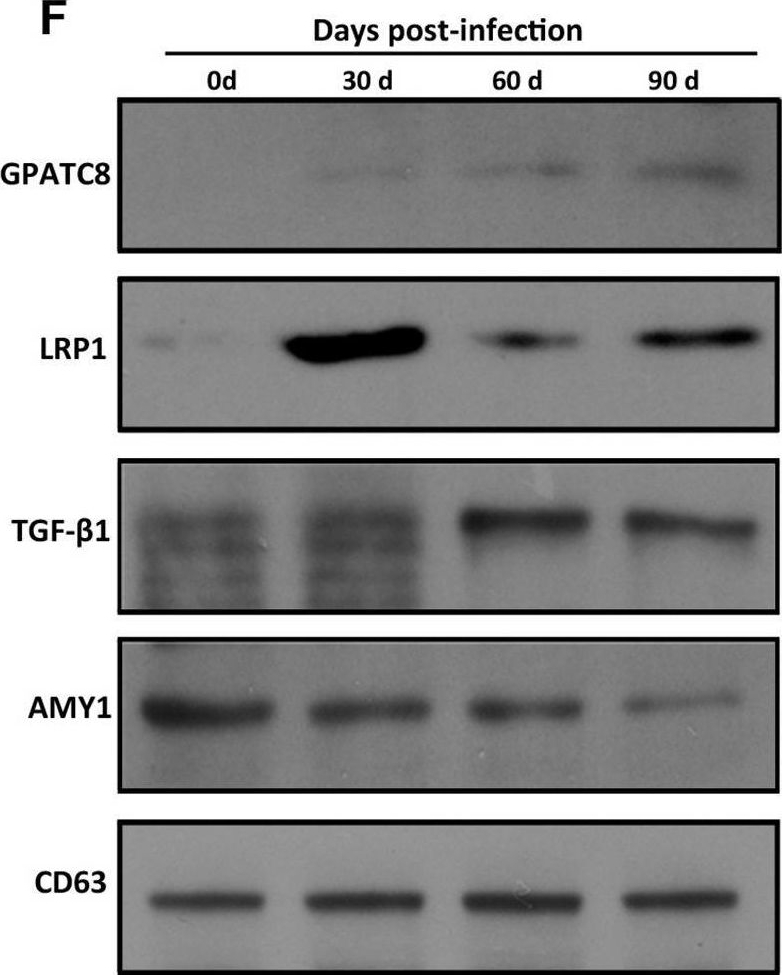 Fig.1.F showing Western Blotting from the publication: Proteomic profiling of serum extracellular vesicles identifies diagnostic markers for echinococcosis.