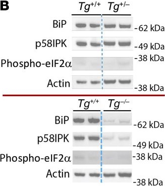 Fig.2.B showing Western Blotting from the publication: Stimulated thyroid hormone synthesis machinery drives thyrocyte cell death independent of ER stress.
