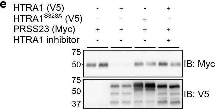 Fig.6.E showing Western Blotting from the publication: Proteomic profiling in cerebral amyloid angiopathy reveals an overlap with CADASIL highlighting accumulation of HTRA1 and its substrates.