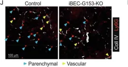 Fig.9.J showing Immunohistochemistry-frozen immunofluorescence in a Mus musculus (House mouse) sample from the publication: Orphan receptor GPR153 facilitates vascular damage responses by modulating cAMP levels, YAP/TAZ signaling, and NF-κB activation.
